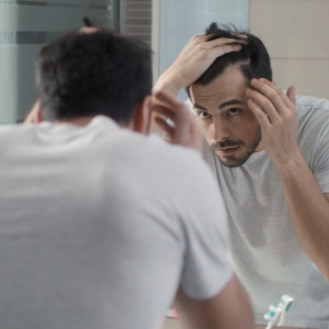 Hair Loss In Canada — Facts, Myths, And Real Solutions