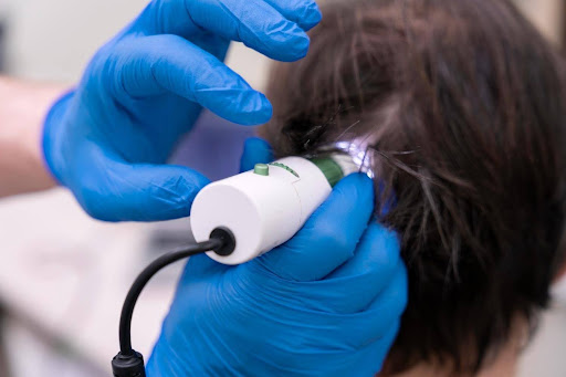 HairMax vs. iRESTORE: Which Laser Hair Growth Device Is Better in 2026?